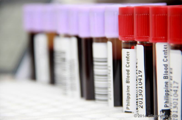 Unpaid donors are subjected to a few tests that include getting blood samples are to test the quality of blood. (Photo: Photoville International)